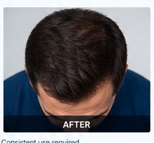 After example