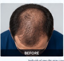 Before example